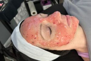 Hydrojelly Masks & Paraffin Masks